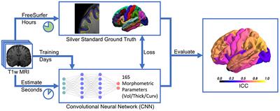 case study of brain morphometry